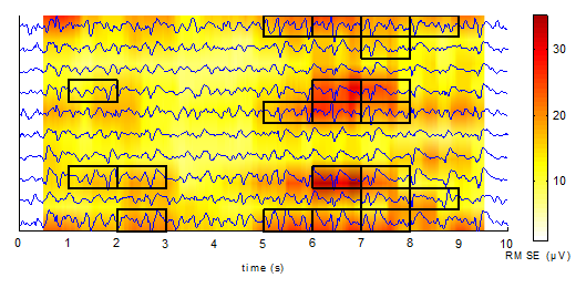 EPViz - Neural Systems Analysis LaboratoryNeural Systems Analysis Laboratory